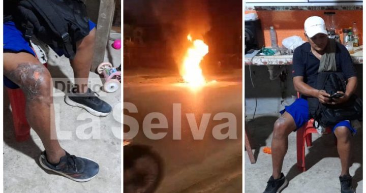 Padre e hija sufren quemaduras en las piernas tras incendiarse su moto